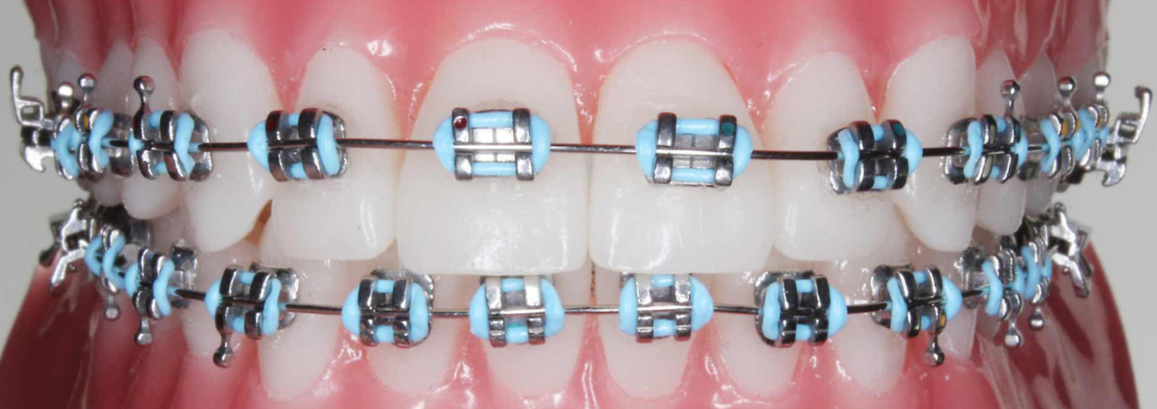 تقويم معدني