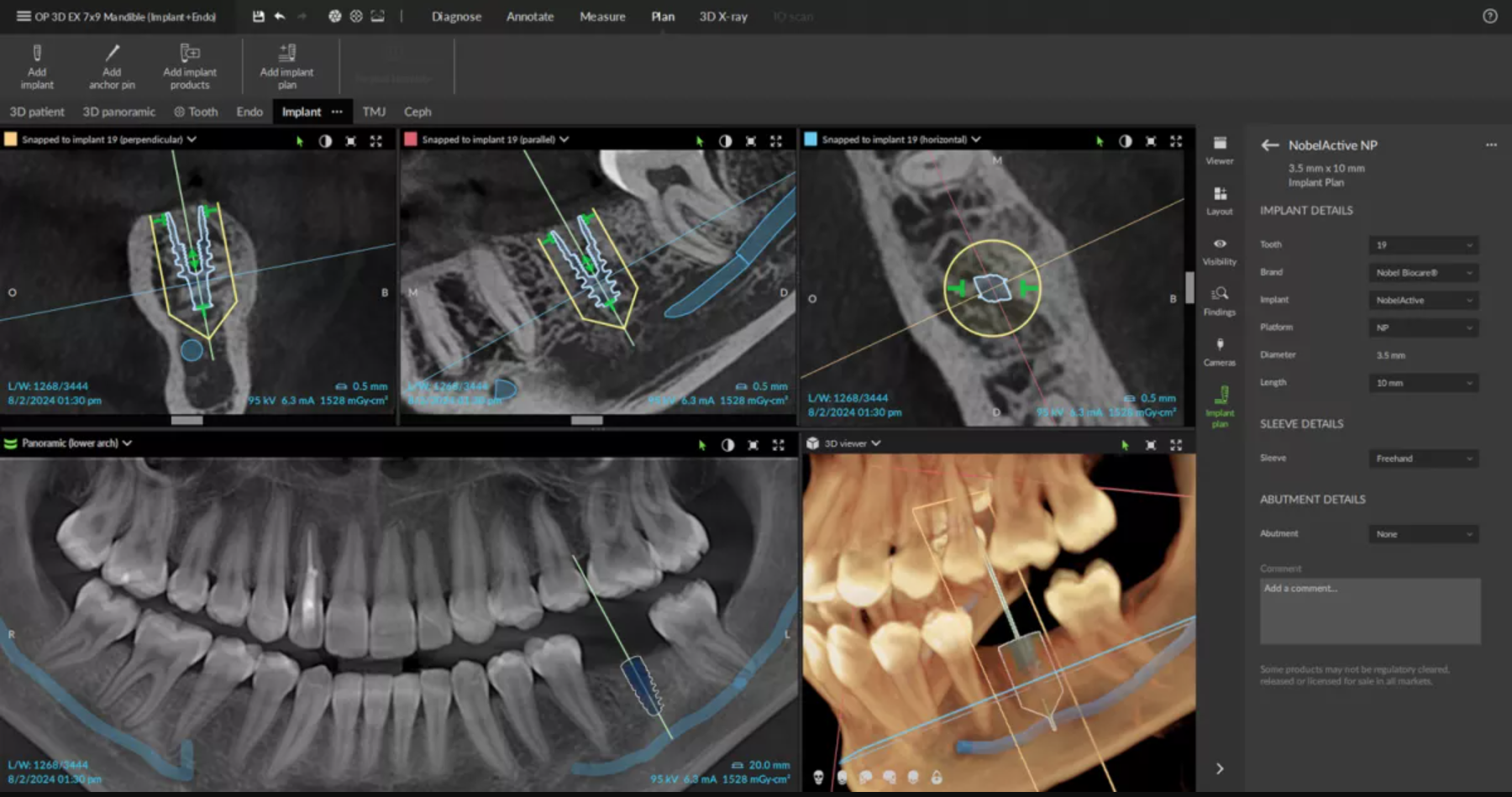Advanced 3D Dental Examination & Implant Planning